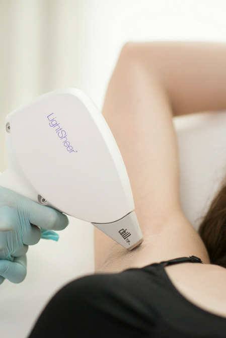 Laser hair removal system