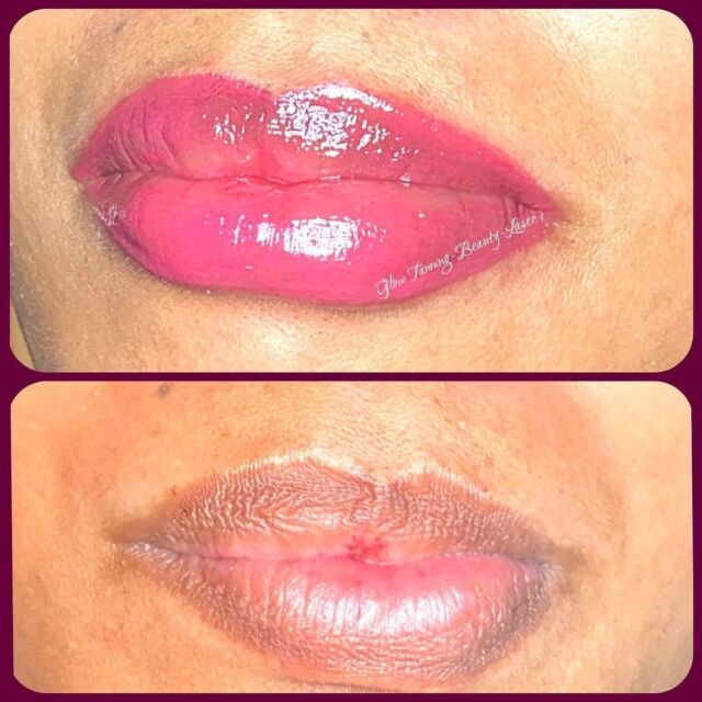 Lips permanent makeup 👄 will heal into a natural soft pink 

.
.
.
.
👄👄👄👄👄👄👄👄👄GLOW👄👄👄👄👄👄👄👄👄👄
.
.
.
.
.
.
.
#permanentmakeup #permanentmakeuplips #pmulips #pmulips💋 #lipspigmentation #lipstattoo #tattoolips #pmulipslondon #micropigmentation #micropigmentationlips #micropigmentationlips💋